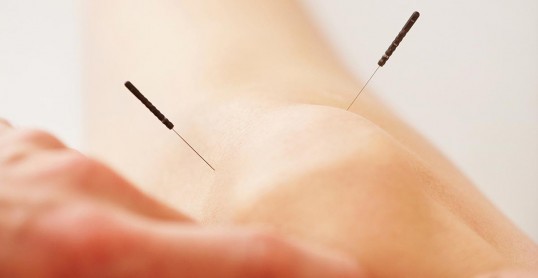 akupunktur i kne